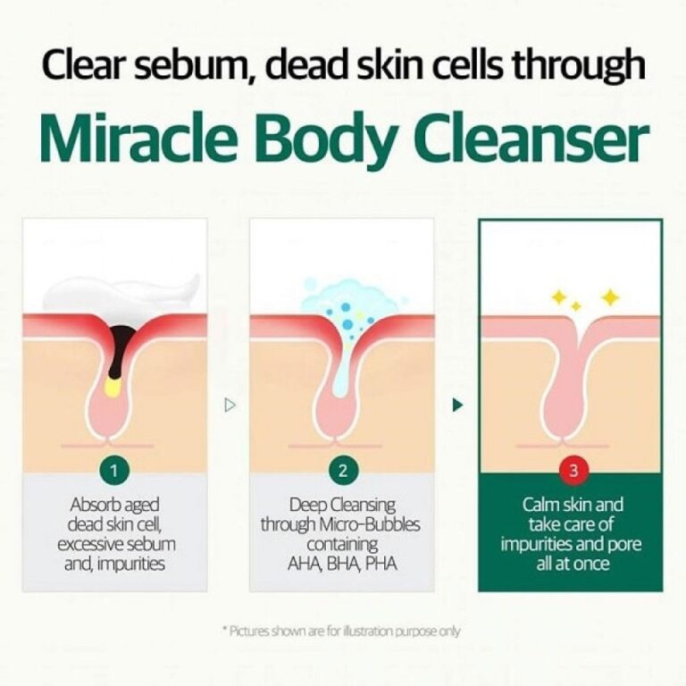 Infografikken forklarer, hvordan Some By Mi - AHA, BHA, PHA 30 Days Miracle Acne Clear Body Cleanser 400g virker: Trin 1 absorberer død hud og urenheder; Trin 2 dybderenser med AHA/BHA/PHA; Trin 3 beroliger huden, vist via porediagrammer.