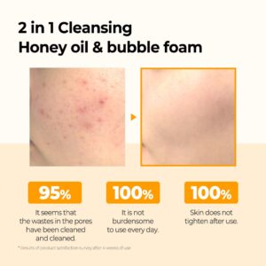 Før- og efterbilleder viser mindre rødme og glattere hud efter brug af Some Bi Mi - Propolis B5 Glow Barrier Calming Oil To Foam 120 ml, med brugertilfredshedsprocenter vist under billederne.