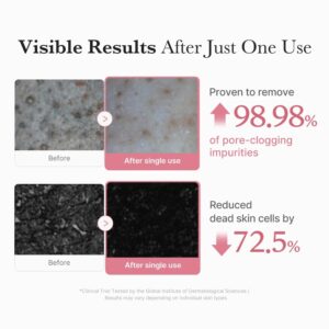 En hudplejesammenligning viser før- og efterbilleder af hud med Medicube - PDRN Pink Niacinamide Whip Cleanser, der fremhæver op til 98,98 % fjernelse af urenheder i porerne og en 72,5 % reduktion af døde hudceller efter én brug.