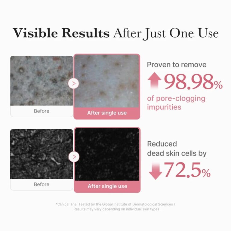 Infografikken viser huden før og efter brug af Medicube - PDRN Hydrating Gel Cleanser. Øverst: nærbillede af porer mærket før og efter, med "Fjerner 98,98% poretilstoppende urenheder." Nederst: "Reducerer døde hudceller med 72,5 %.