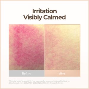 Billeder af huden side om side viser rød, irriteret hud mærket Før og roligere, mindre rød hud mærket Efter. Teksten ovenover lyder: Irritation synligt beroliget med Cell Fusion C - Skin Blemish Balm Intensive - Light.